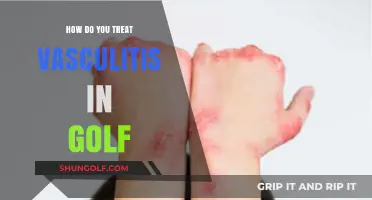 Treating Vasculitis in Golfers: Effective Strategies for Pain Relief and Recovery