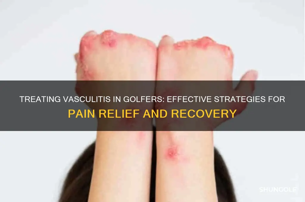 how do you treat vasculitis in golf