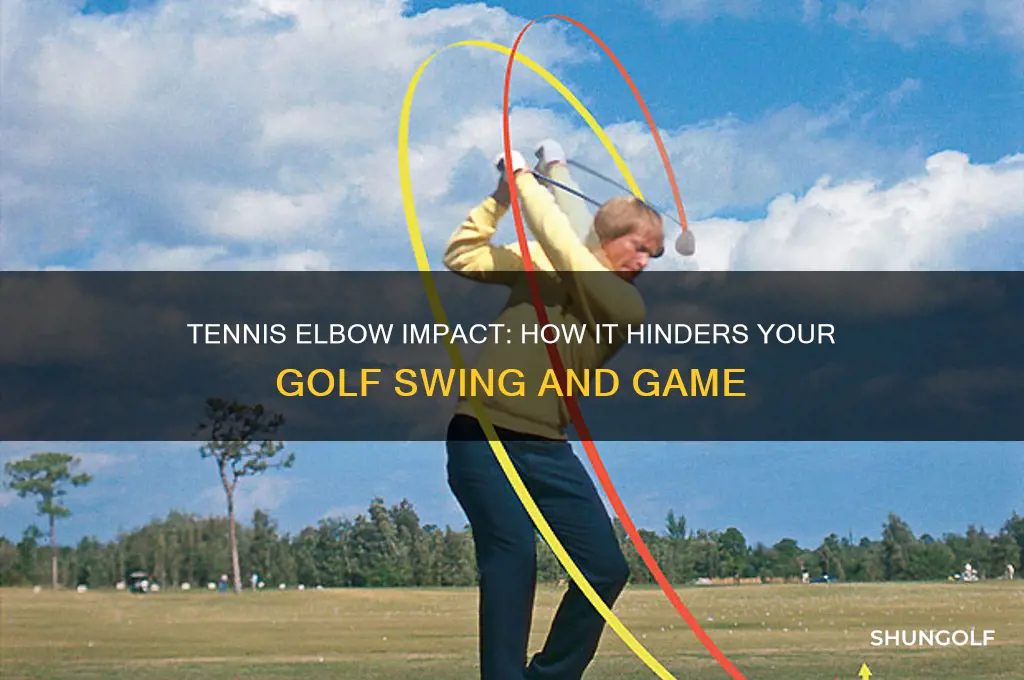 how does tennis elbow affect my golf game