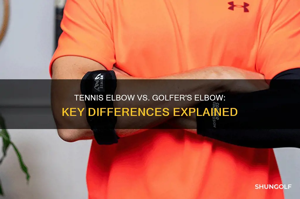 how does tennis elbow differ from golfer