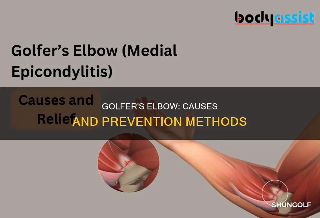 how dose a golfer elbow happen