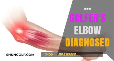 Golfer's Elbow: Diagnosis and Treatment Options