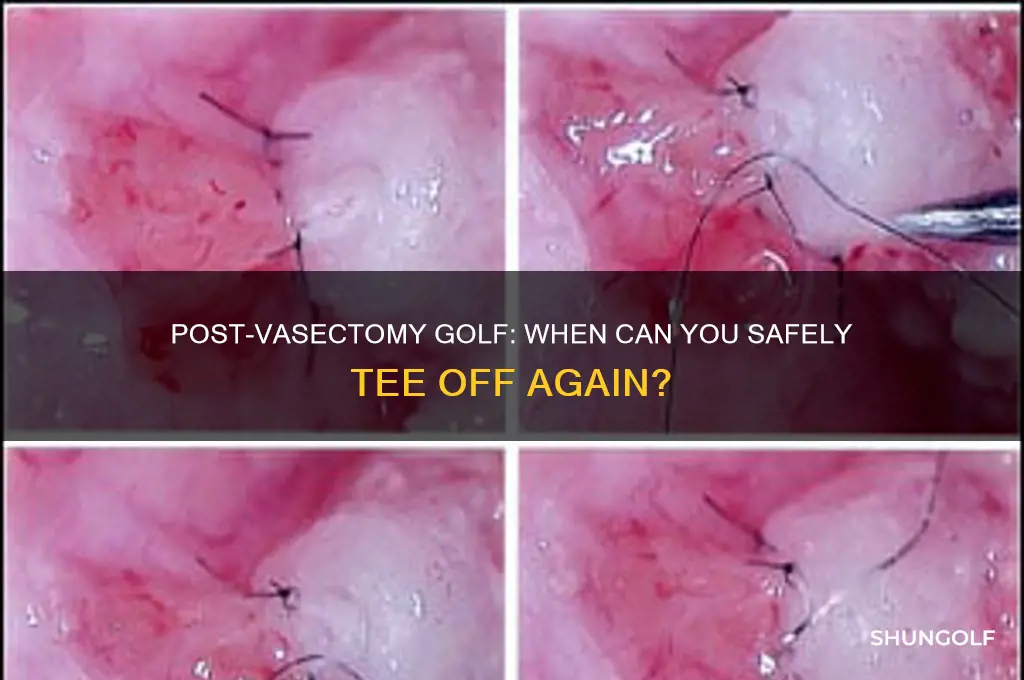 how long after a vasectomy can i play golf