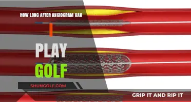 Golf After Angiogram: Safe Return to the Course Timeline