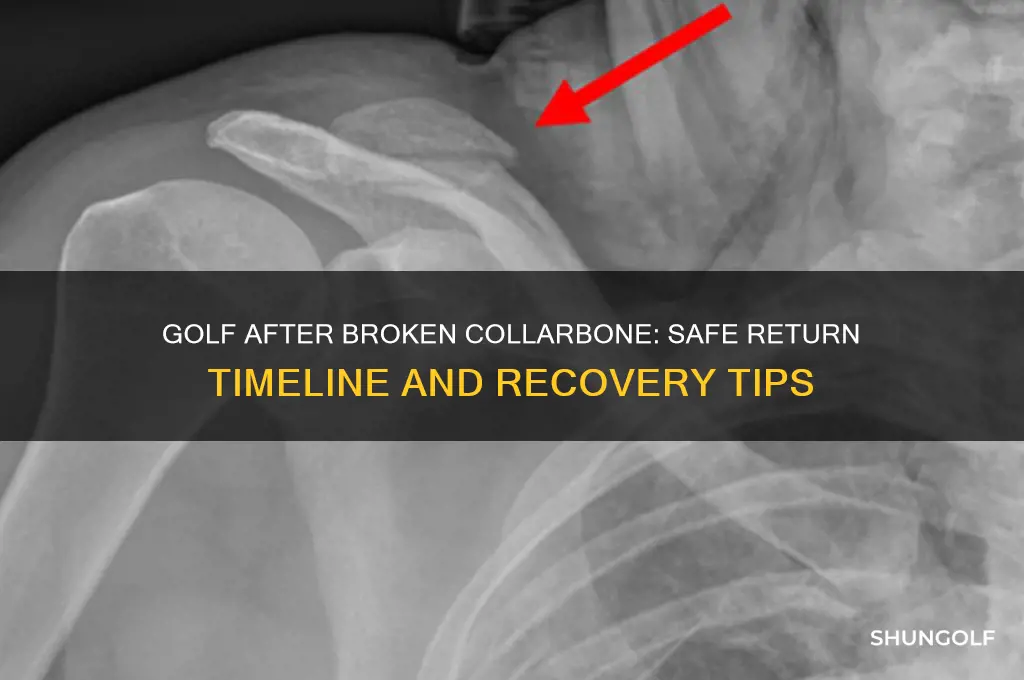 how long before a broken collarbone can i play golf