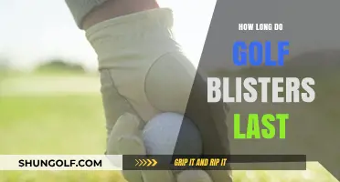 Golf Blisters: How Long Do They Last?