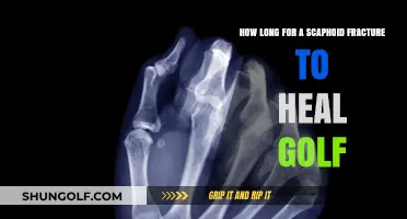 Scaphoid Fracture Healing Time: Golf Recovery Timeline and Tips
