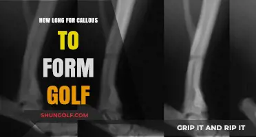How Long Does It Take for Golf Calluses to Form?