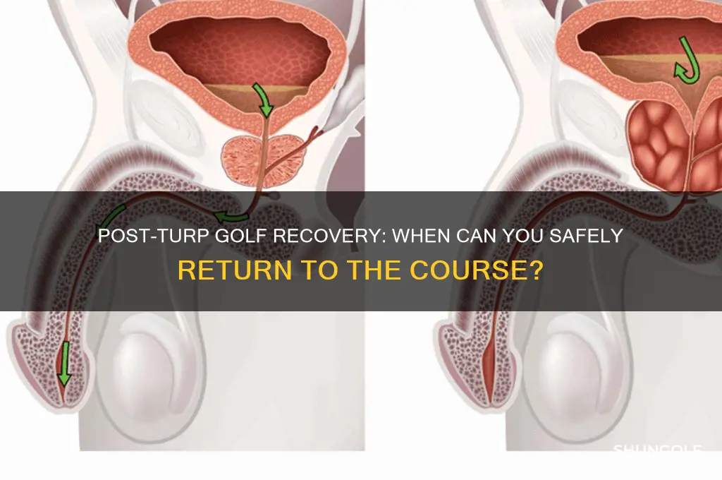 how long to play golf after turp surgery