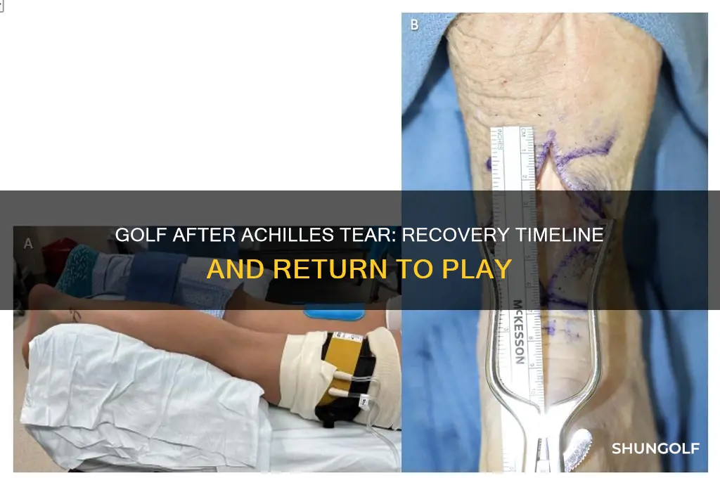 how long to recover achilles tear for golf