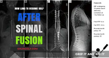 Returning to Golf Post-Spinal Fusion: Safe Recovery Timeline and Tips
