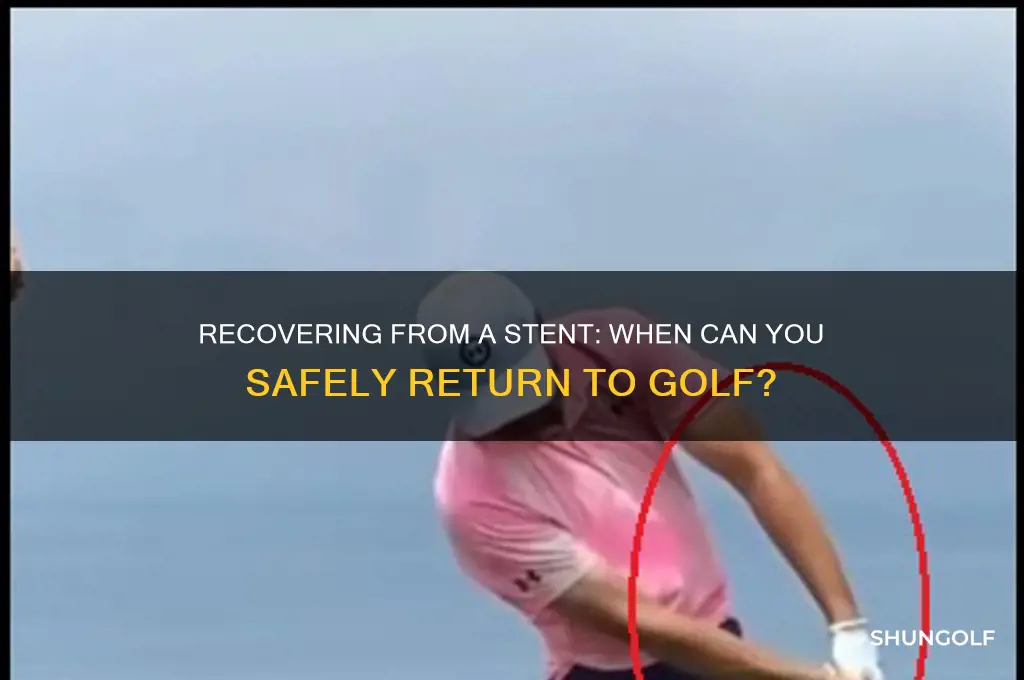 how soon can i play golf after a stent