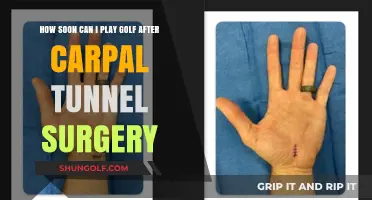 Golf After Carpal Tunnel Surgery: Safe Recovery Timeline for Players