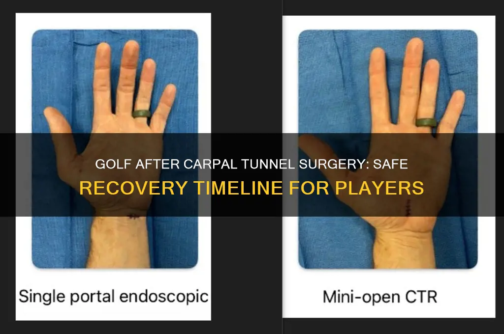 how soon can i play golf after carpal tunnel surgery