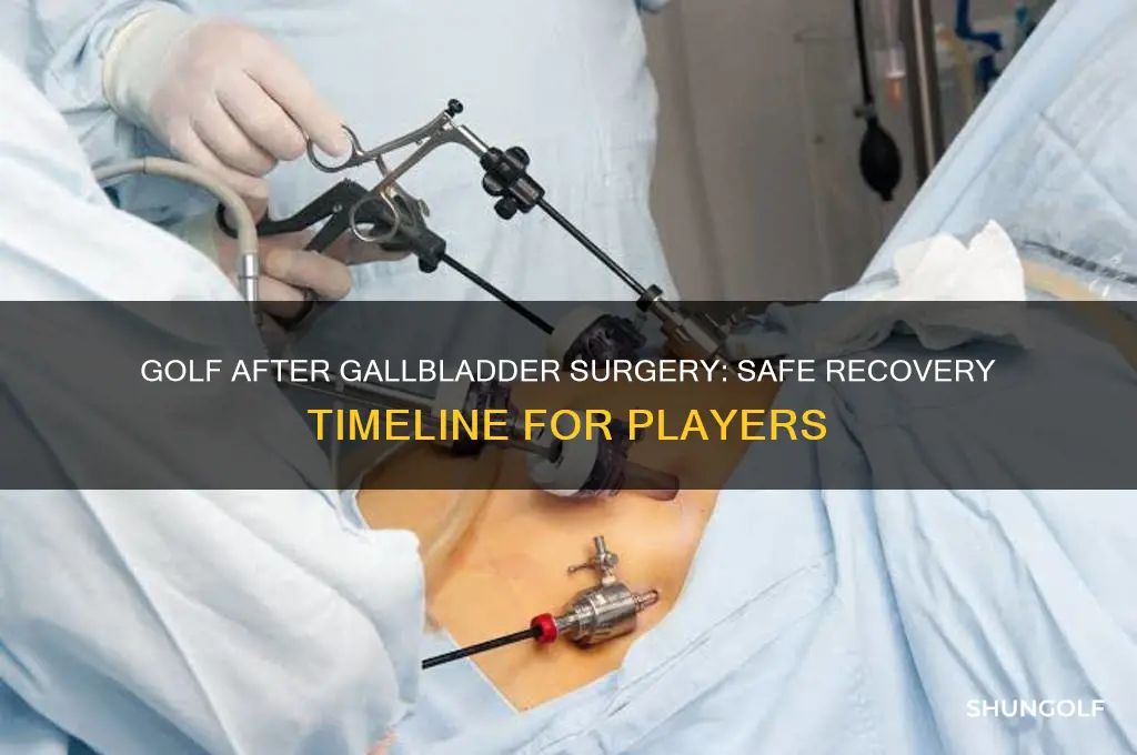 how soon can i play golf after gallbladder surgery