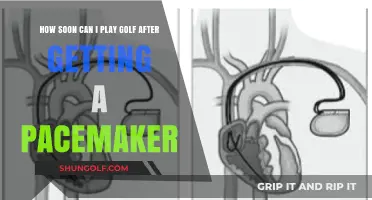 Golf After Pacemaker: Safe Return to the Course Timeline