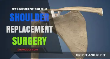 Golf After Shoulder Replacement: Safe Return to the Course Timeline