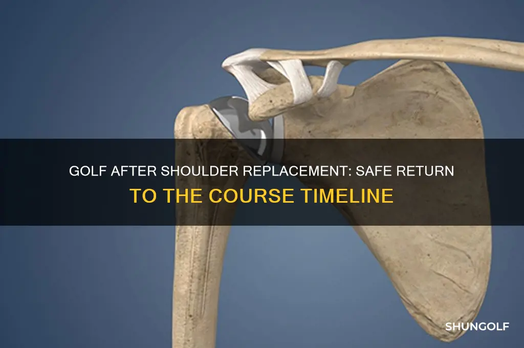 how soon can i play golf after shoulder replacement surgery