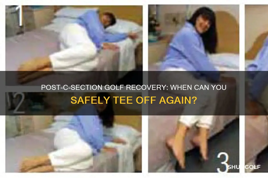 how soon can you play golf after a c-section