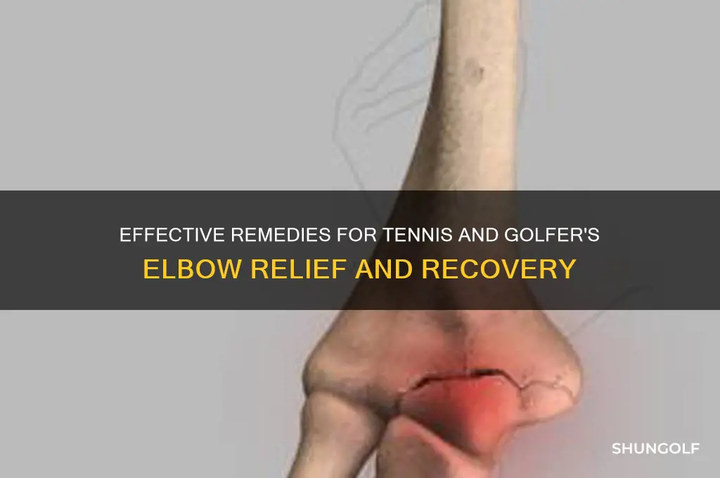 how to cure tennis and golfer