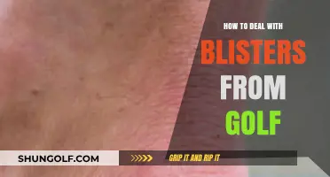 Effective Tips to Treat and Prevent Golf-Related Blisters Fast