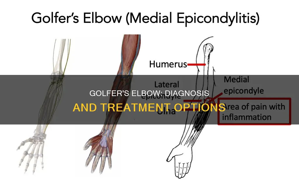 how to diagnose golfer