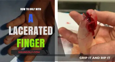 Golfing with a Lacerated Finger: Tips for a Pain-Free Swing