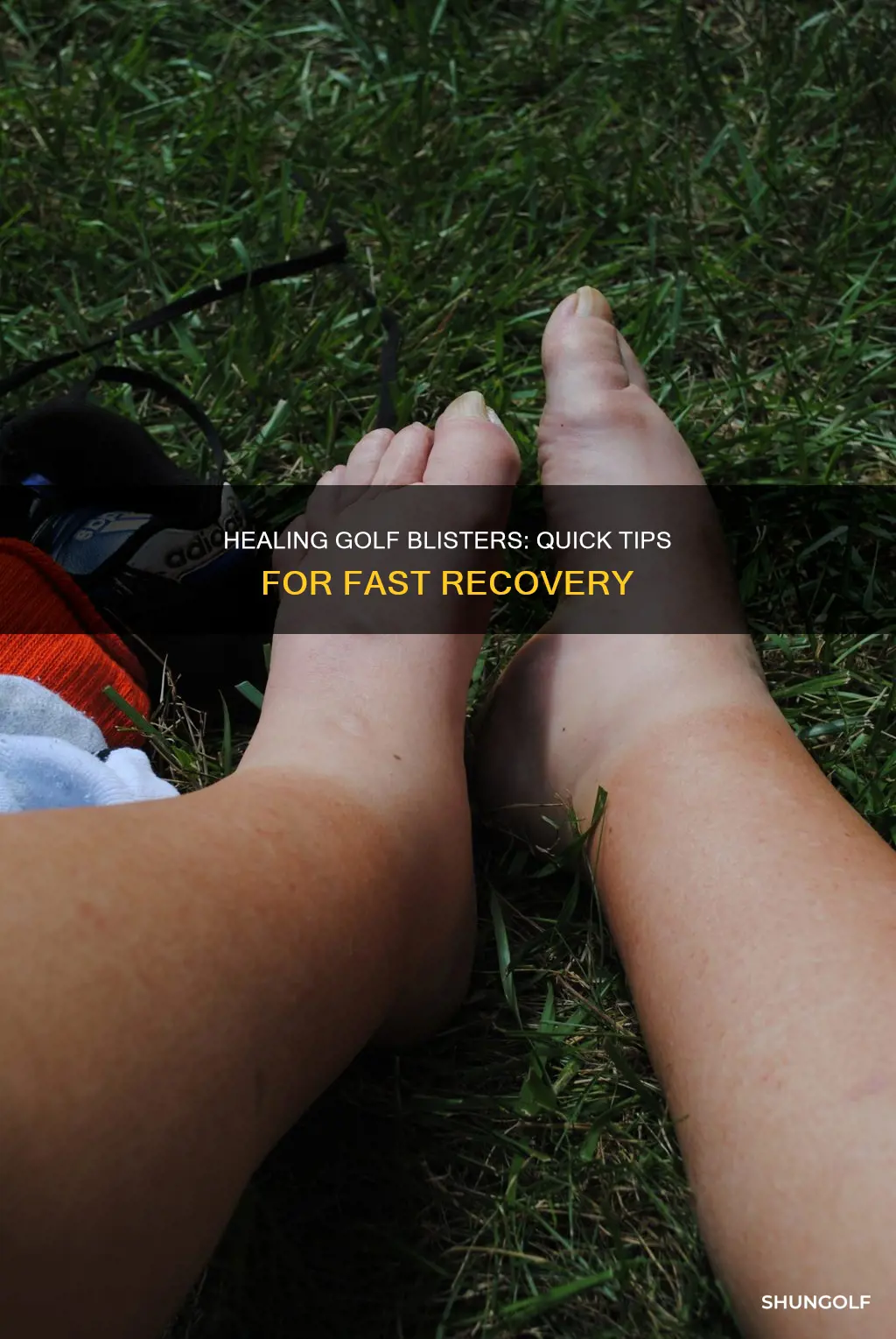 how to heal a golf blister
