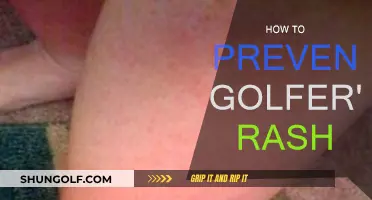 Preventing Golfer's Rash: Tips for Comfort on the Course