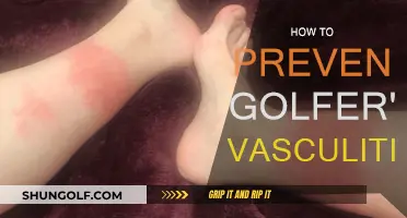 Preventing Golfer's Vasculitis: Tips for Healthy Hands