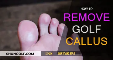 Eradicating Golf Calluses: Techniques for Smooth Hands