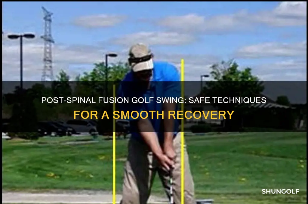 how to swing a golf club after spinal fusion