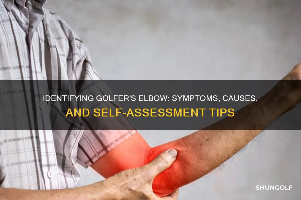 how to tell if i have golfer