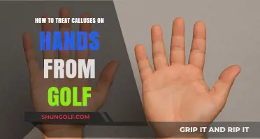 Effective Treatments for Golf-Induced Hand Calluses: Relief and Prevention Tips