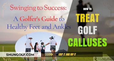 Golf Calluses: Treating and Preventing Hand Calluses