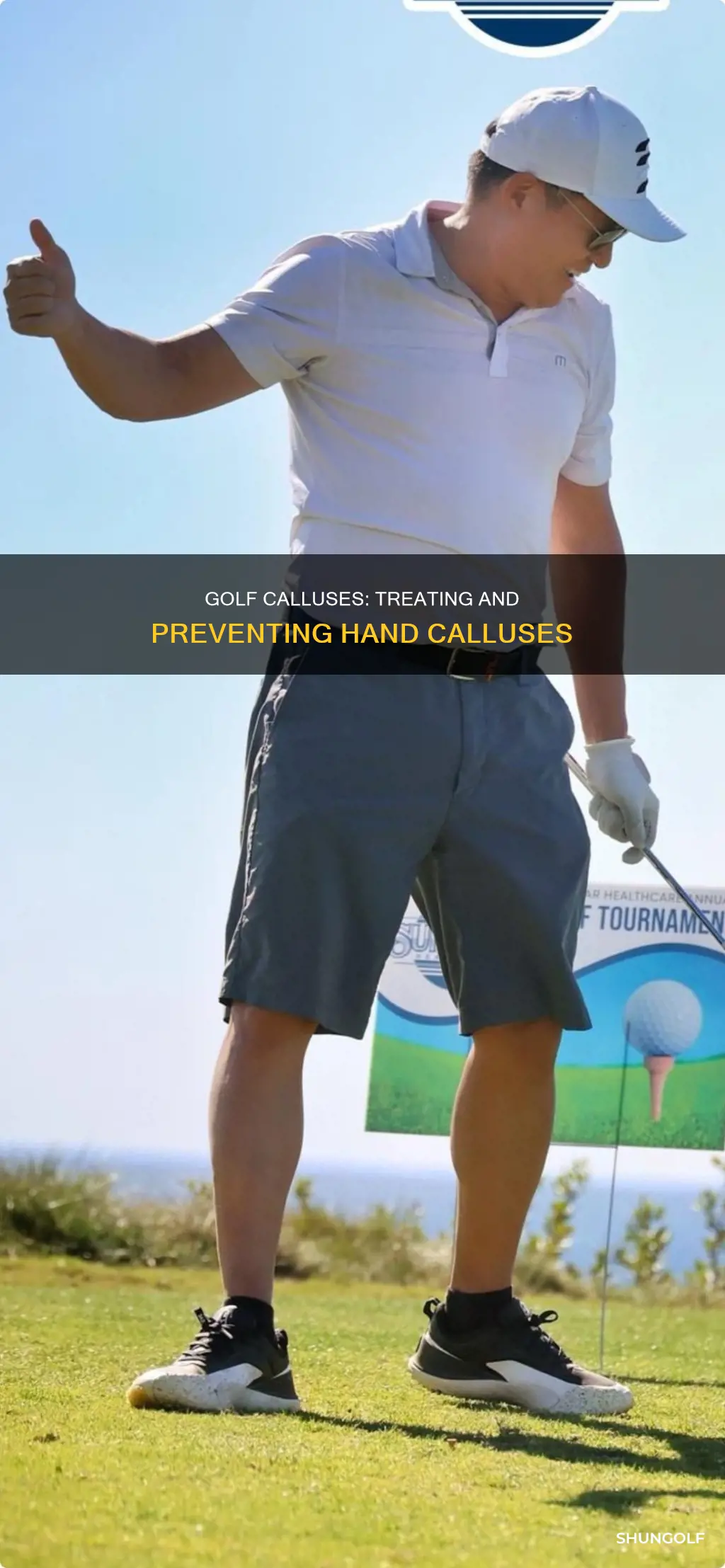 how to treat golf calluses