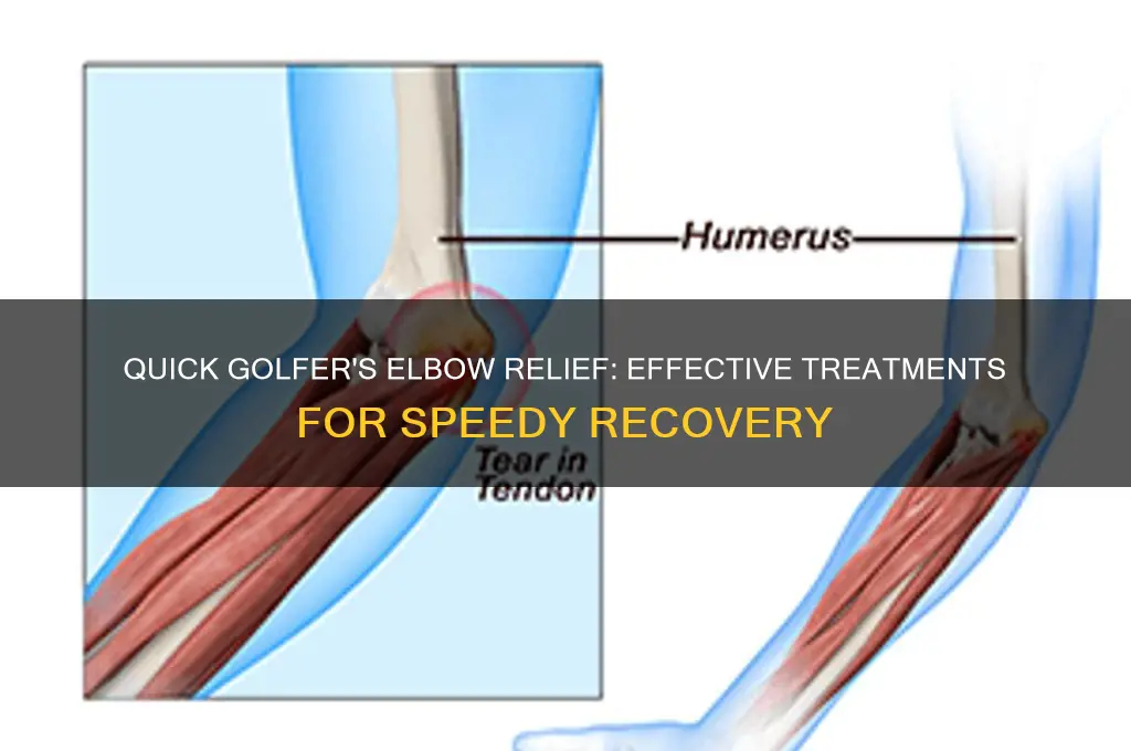 how to treat golfer
