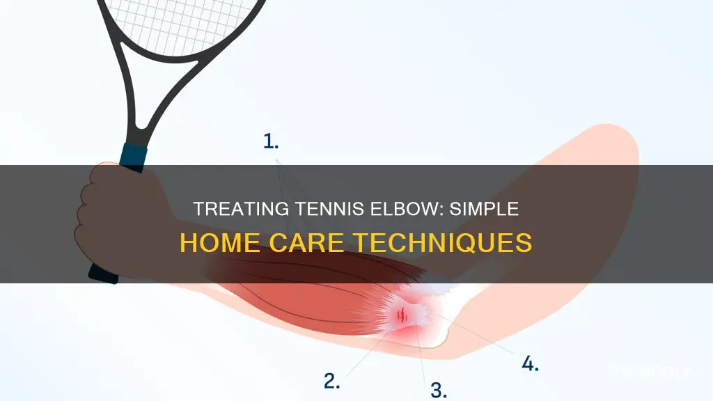 how to treat tennis golf elbow