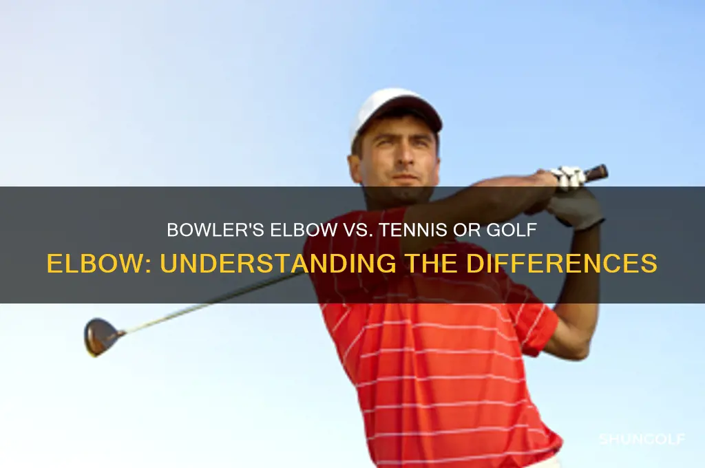 is bowlers elbow the same tennis or golf
