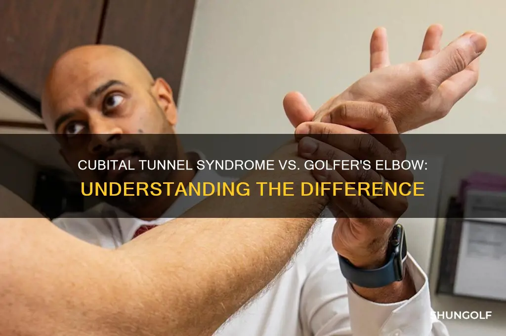 is cubital tunnel syndrome the same as golfer