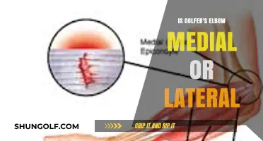 Golfer's Elbow Explained: Understanding Medial vs. Lateral Elbow Pain