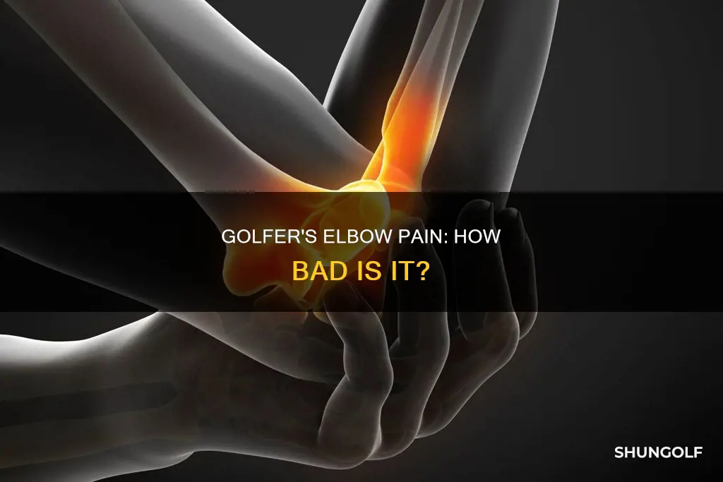 is golfer
