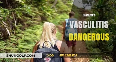 Golfer's Vasculitis: A Dangerous and Painful Condition