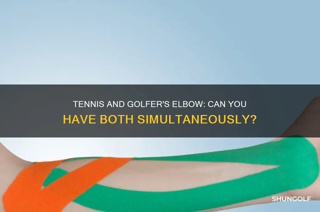 is it possible to have tennis and golfer