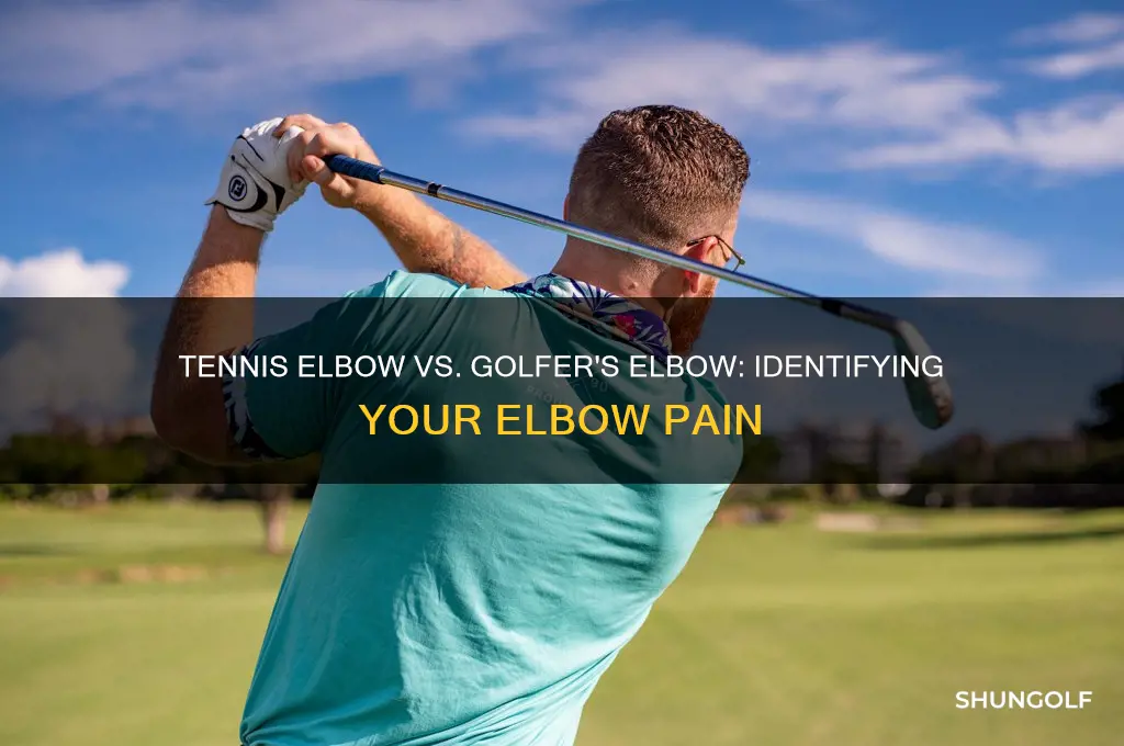 is it tennis elbow or golfer
