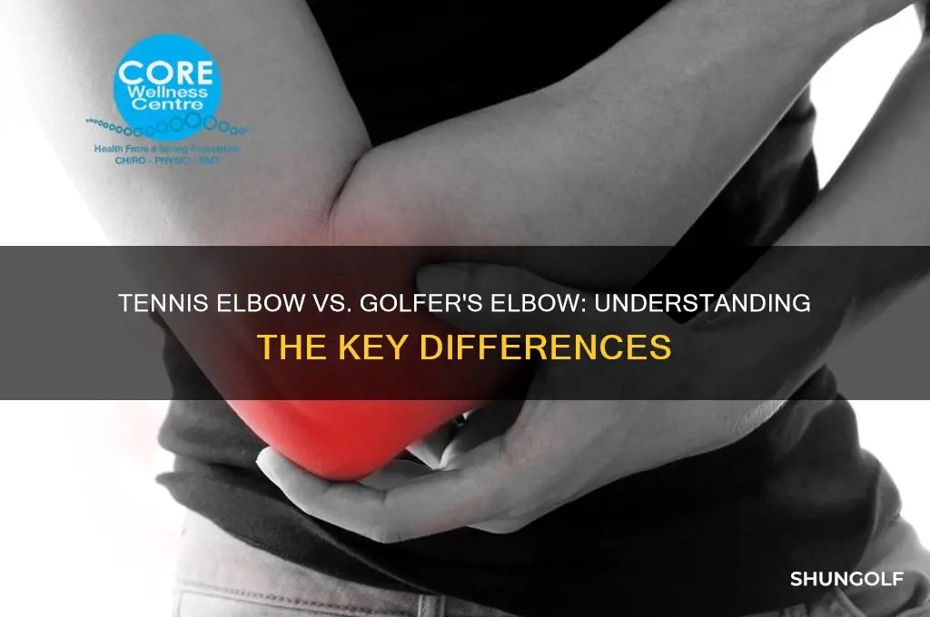 is tennis elbow and golfer