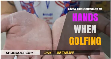 Golfing and Hand Calluses: Are They Necessary or a Hindrance?