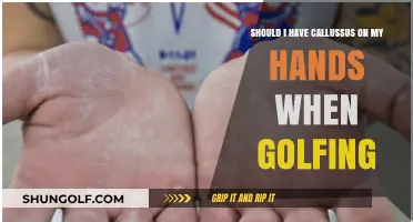 Golfing and Hand Calluses: Are They Necessary or a Hindrance?