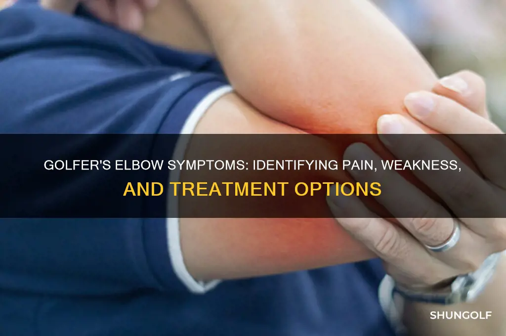 what are the symptoms of golfer
