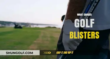 Golf Grip: Why Blisters Form and How to Prevent Them